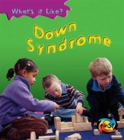 Down_s_syndrome